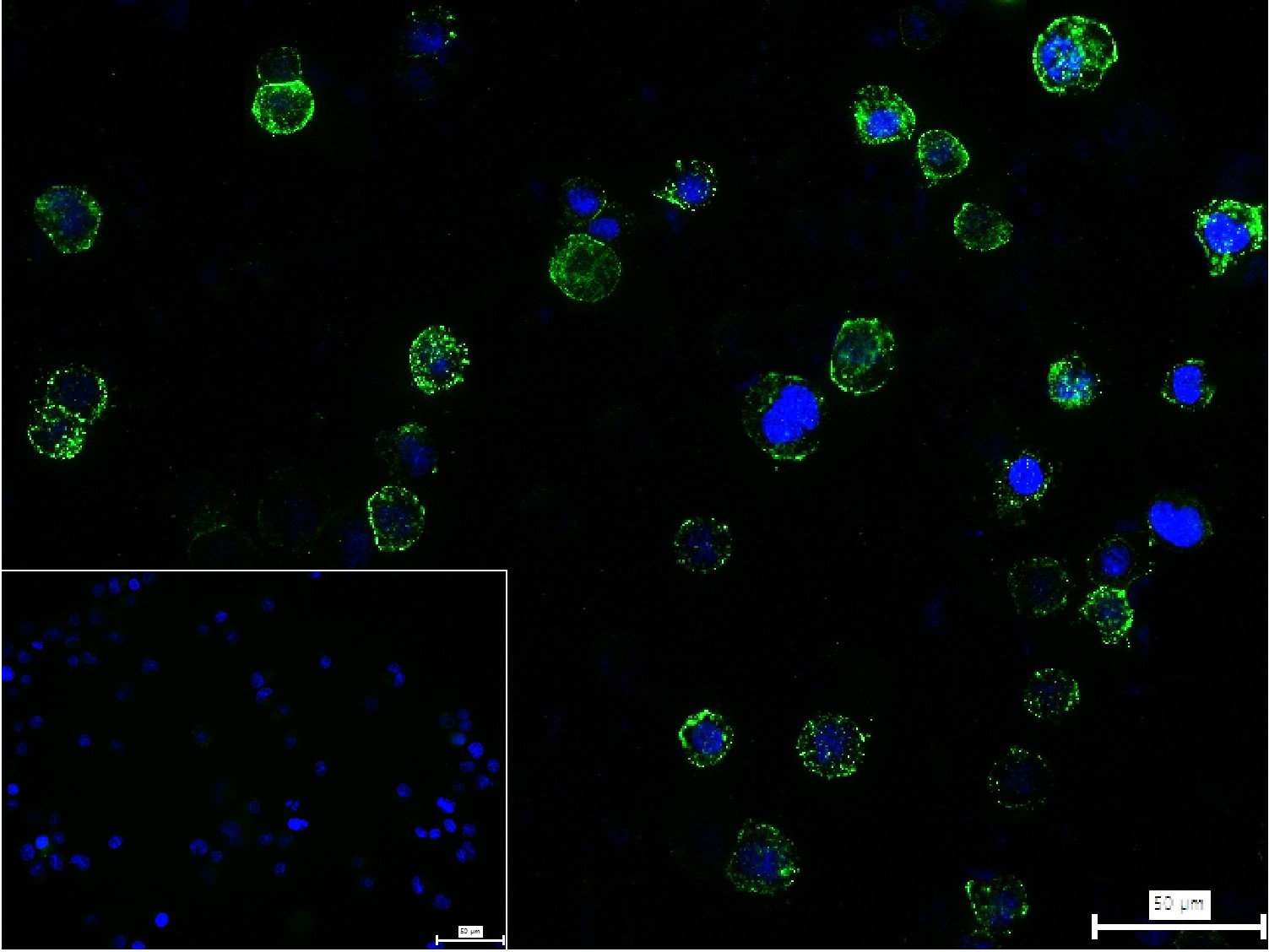 ADAM17重组兔单抗