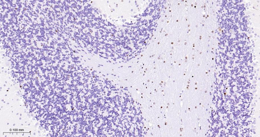 少突胶质细胞转录因子2重组兔单抗