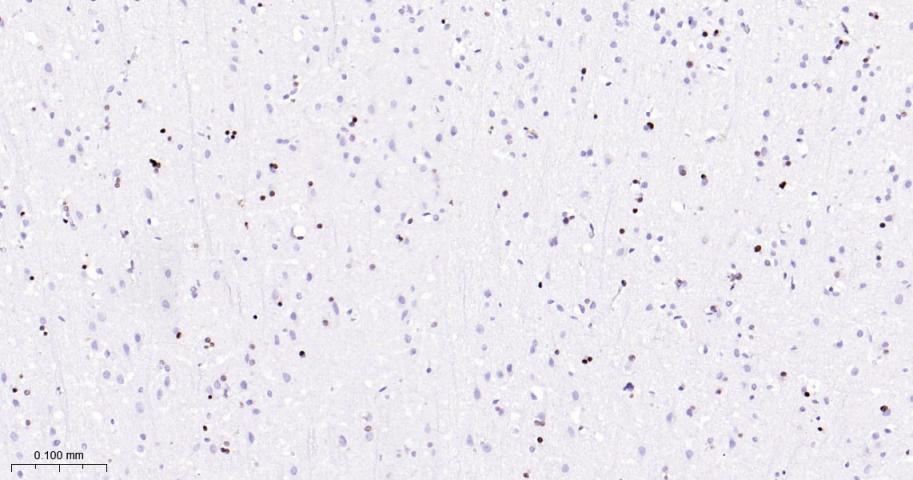 少突胶质细胞转录因子2重组兔单抗
