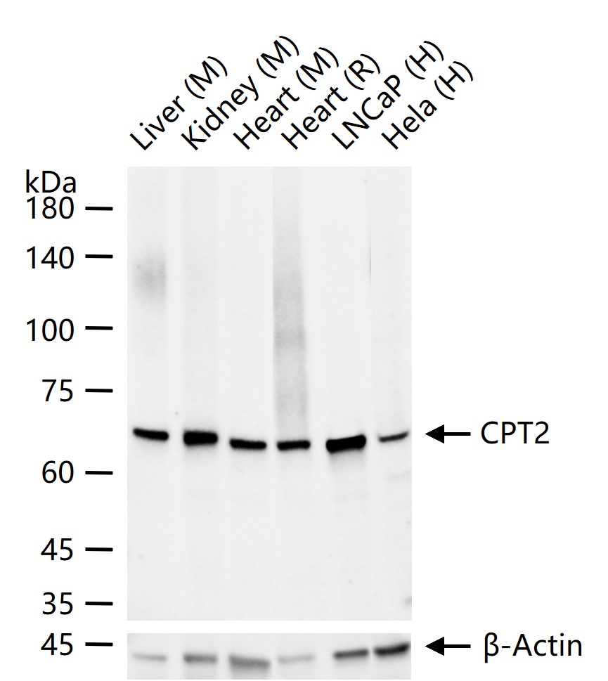 肉毒碱棕榈酰基转移酶2重组兔单抗