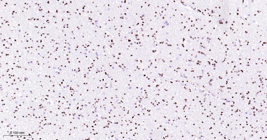 少突胶质细胞转录因子2重组兔单抗