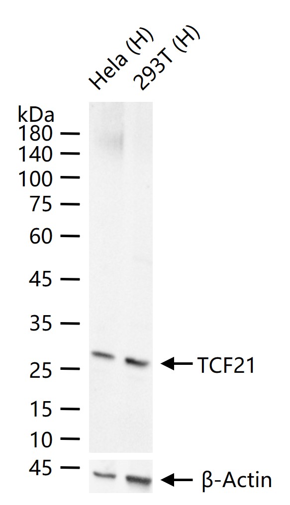足细胞表达蛋白/转录因子21重组兔单抗