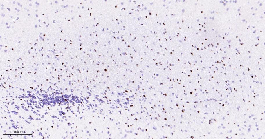 少突胶质细胞转录因子2重组兔单抗