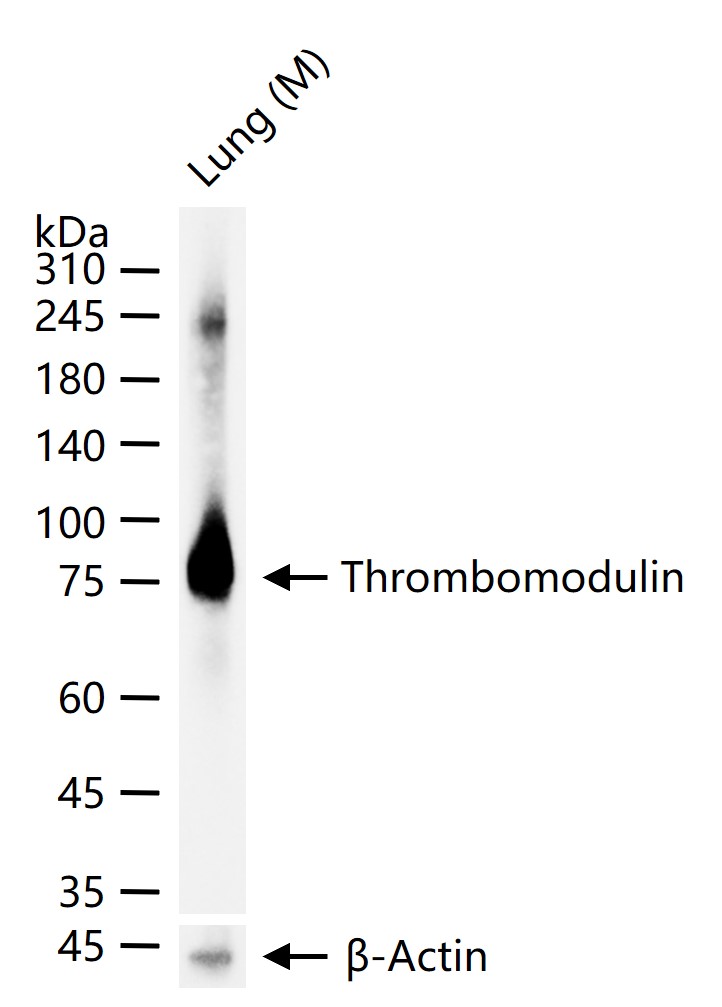 血栓调节蛋白重组兔单抗