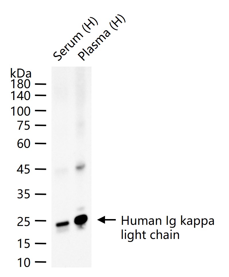 人k轻链重组兔单抗