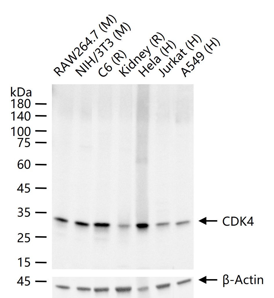 周期素依赖性激酶4重组兔单抗