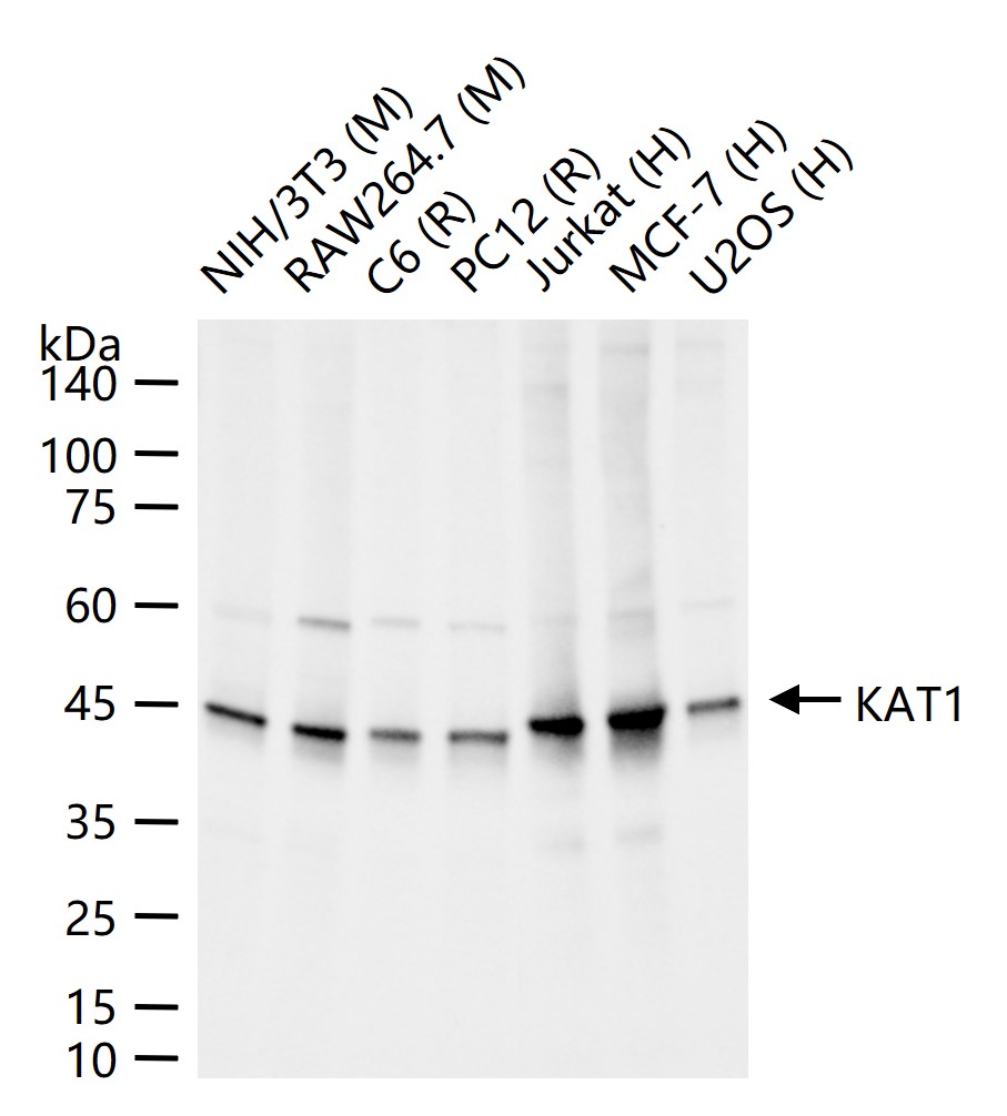 KAT1重组兔单抗