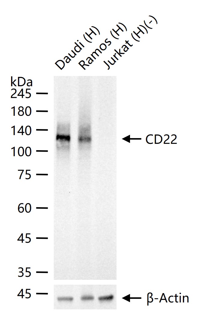 B淋巴细胞粘附分子CD22重组兔单抗