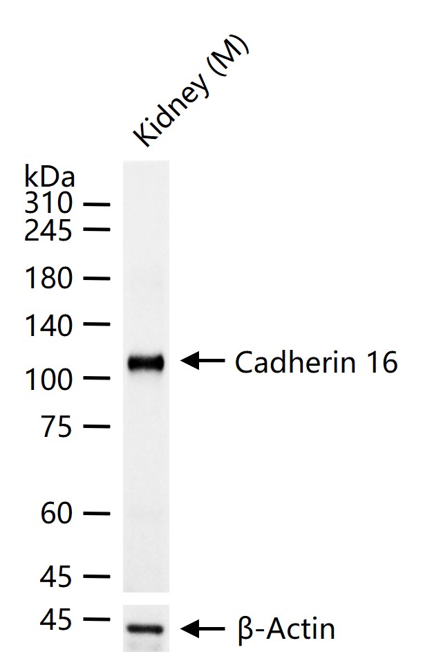 钙粘蛋白16重组兔单抗