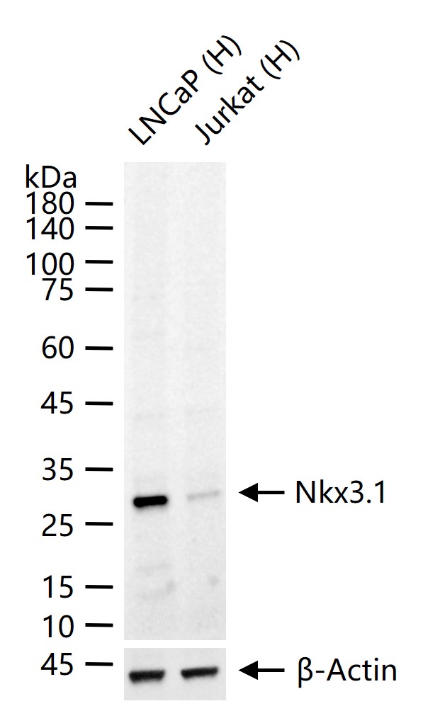 转录因子同源蛋白Nkx3.1重组兔单抗