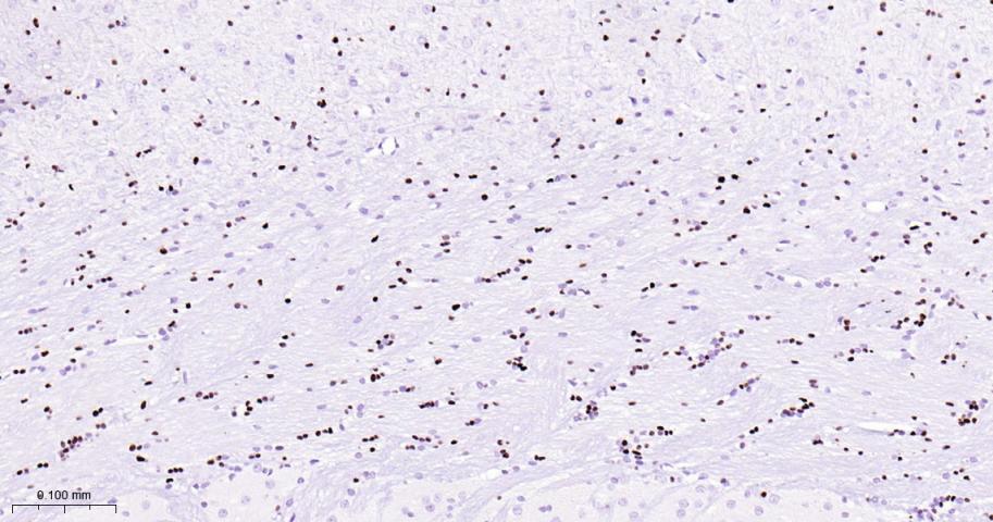 少突胶质细胞转录因子2重组兔单抗