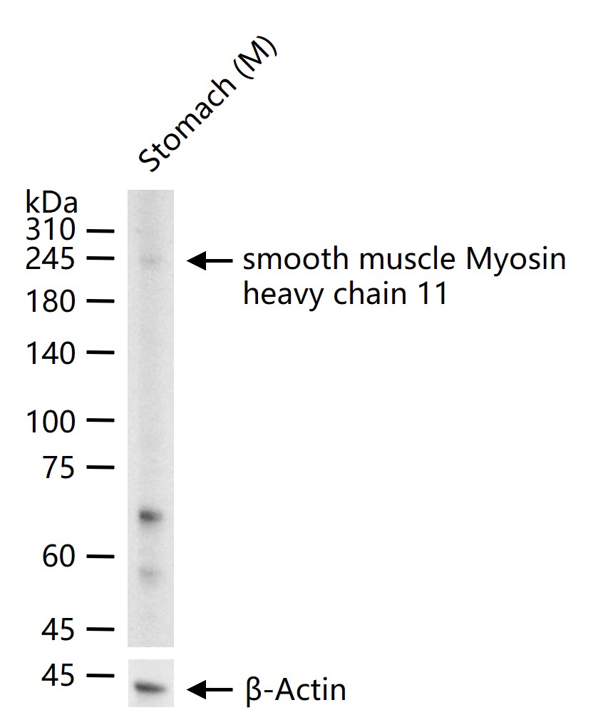 平滑肌肌球蛋白重链抗体