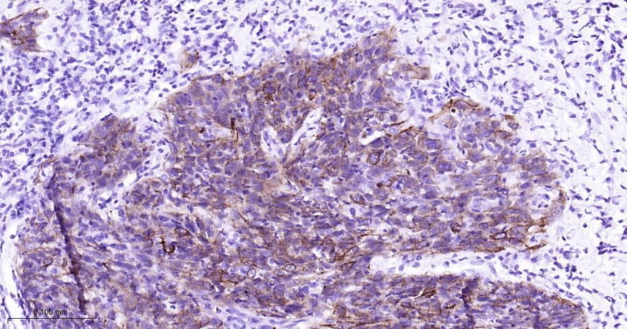 细胞角蛋白7重组兔单抗
