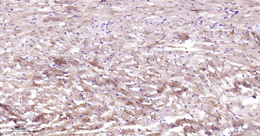 自噬相关蛋白4A重组兔单抗-bsm-61617R