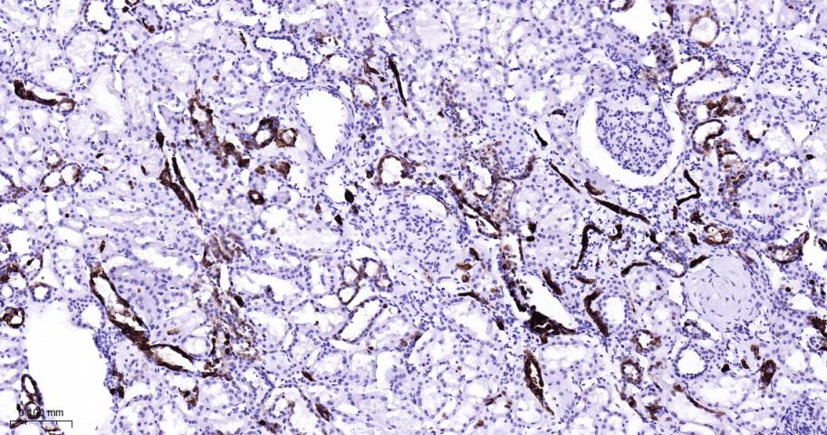 细胞角蛋白7重组兔单抗