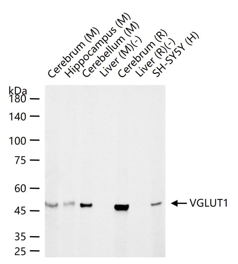 VGLUT1 Recombinant Rabbit mAb (一抗) - WB | Bioss