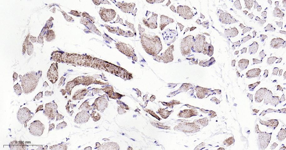 自噬相关蛋白4A重组兔单抗-bsm-61617R