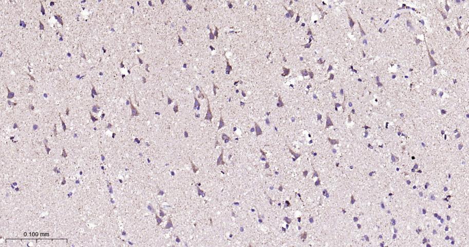 自噬相关蛋白4A重组兔单抗-bsm-61617R