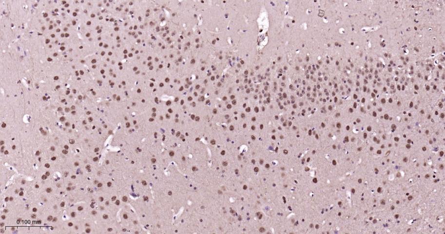 蛋白酶体PSMα1重组兔单抗-bsm-60572R