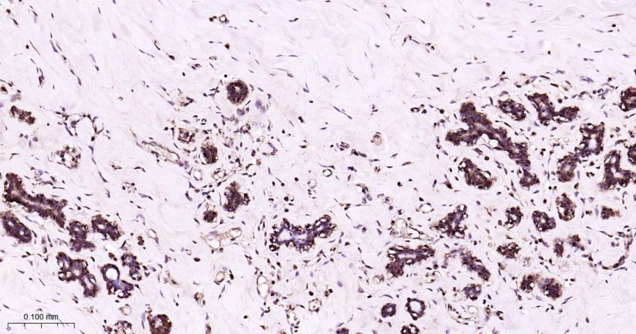 蛋白酶体PSMα1重组兔单抗-bsm-60572R