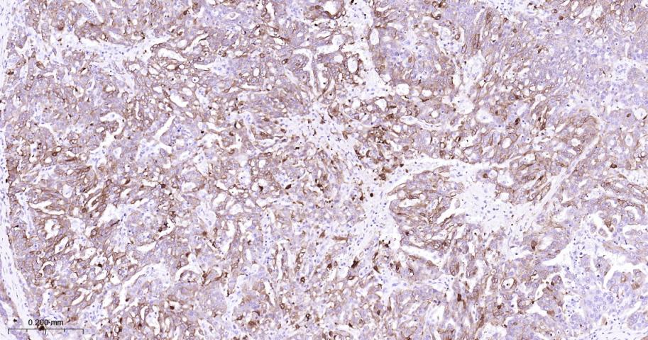 细胞角蛋白7重组兔单抗