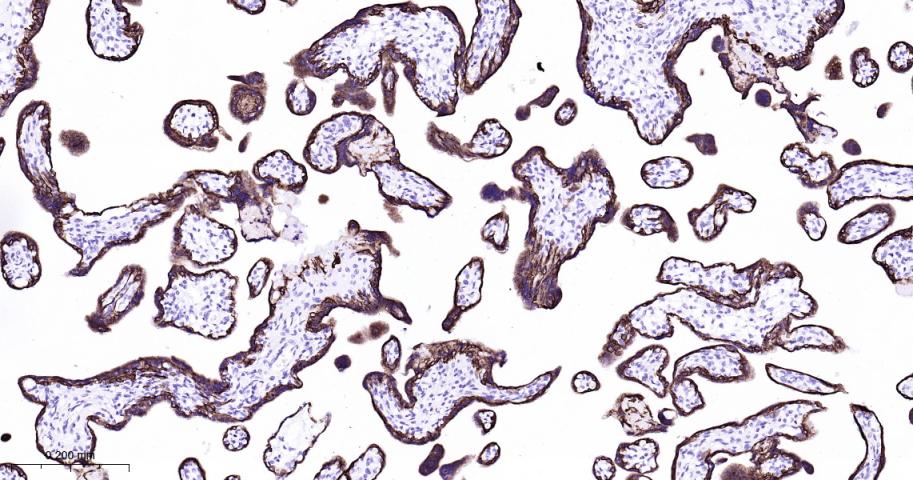 细胞角蛋白7重组兔单抗
