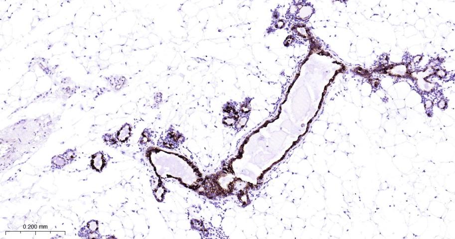 细胞角蛋白7重组兔单抗