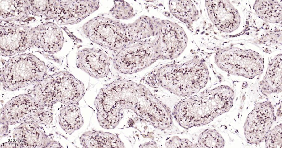细胞信号转导分子SMAD5 重组兔单抗