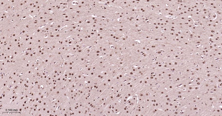 蛋白酶体PSMα1重组兔单抗-bsm-60572R