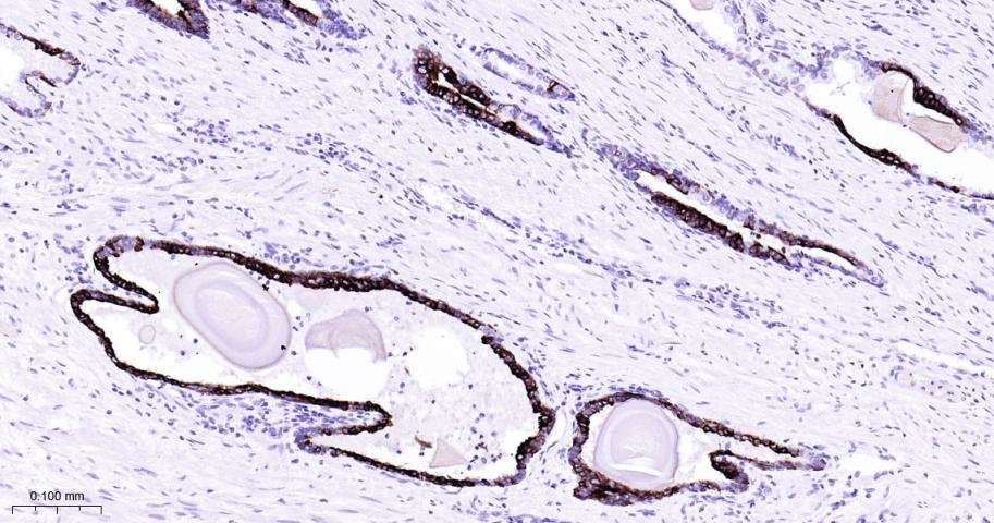 细胞角蛋白7重组兔单抗
