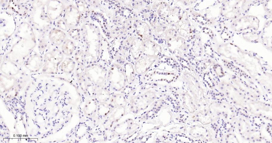 泛素结合蛋白P62重组兔单抗