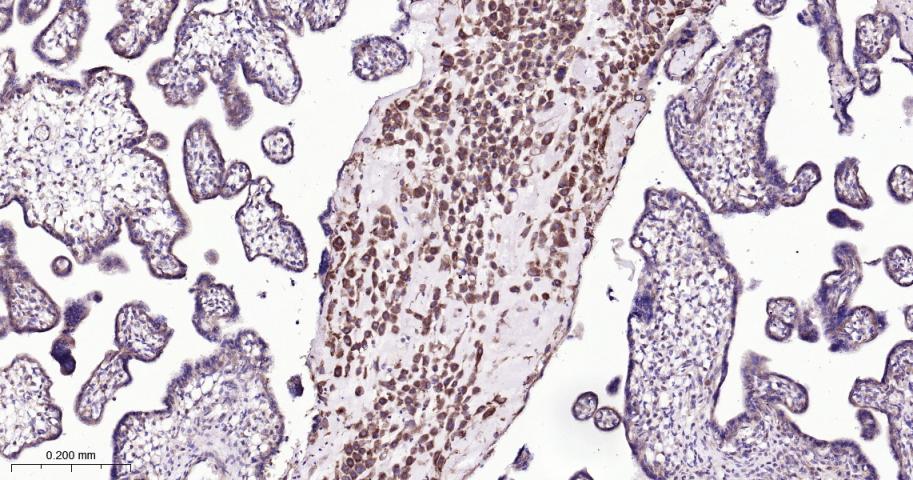 自噬蛋白5重组兔单抗