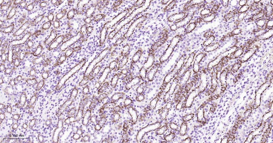 自噬相关蛋白4A重组兔单抗-bsm-61617R