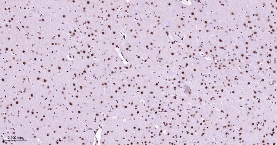 异染色质蛋白1-α重组兔单抗-bsm-61202R