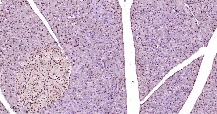异染色质蛋白1-α重组兔单抗-bsm-61202R