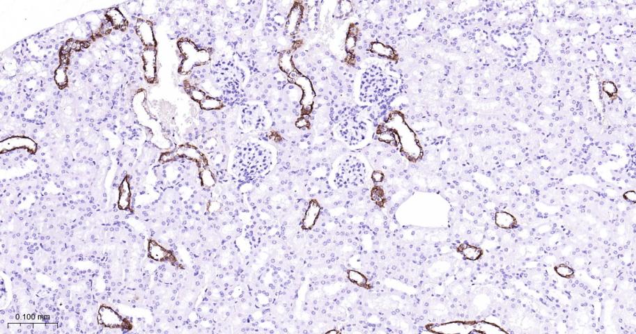 细胞角蛋白7重组兔单抗