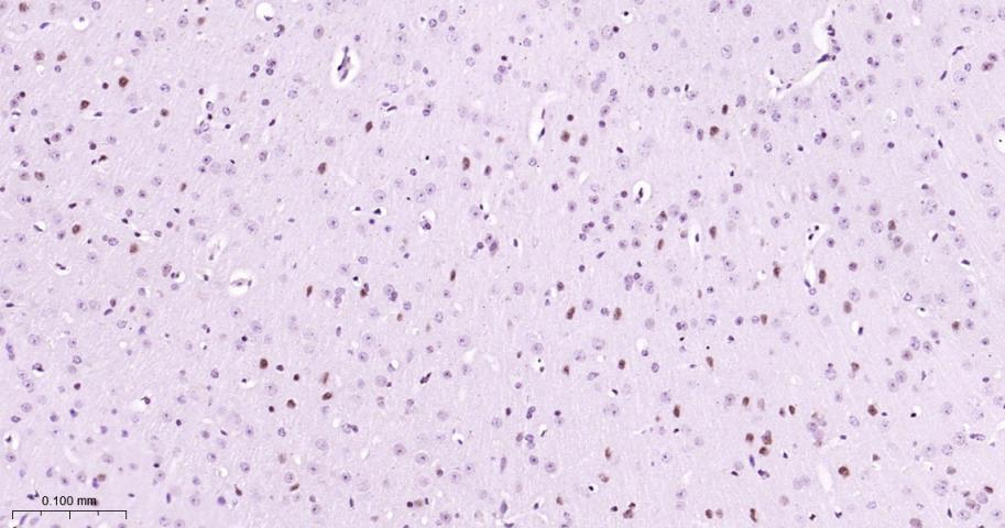 磷酸化丝裂原活化蛋白激酶激酶1重组兔单抗