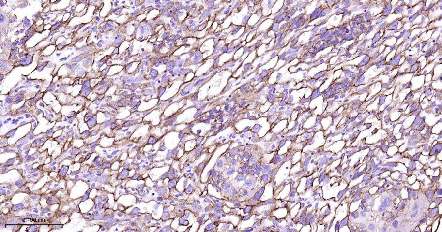 细胞角蛋白7重组兔单抗