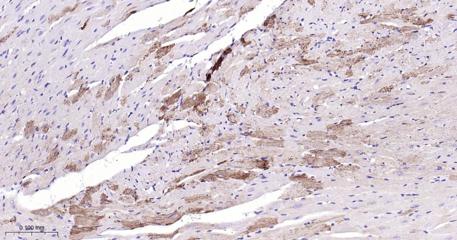 自噬相关蛋白4A重组兔单抗-bsm-61617R