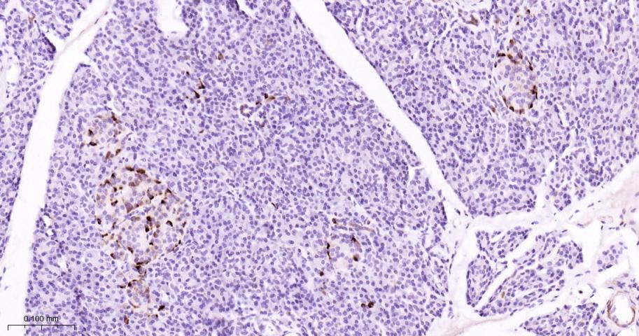 磷酸化丝裂原活化蛋白激酶激酶1重组兔单抗
