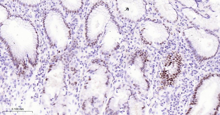 泛素结合蛋白P62重组兔单抗