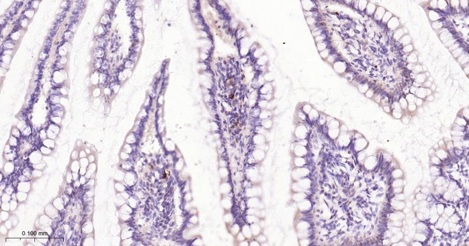 泛素结合蛋白P62重组兔单抗