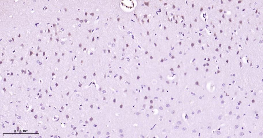 磷酸化丝裂原活化蛋白激酶激酶1重组兔单抗