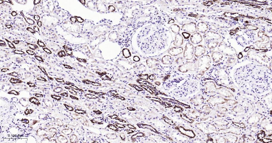 自噬相关蛋白4A重组兔单抗-bsm-61617R