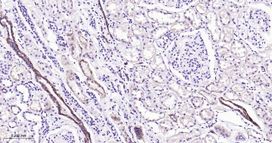 自噬蛋白5重组兔单抗
