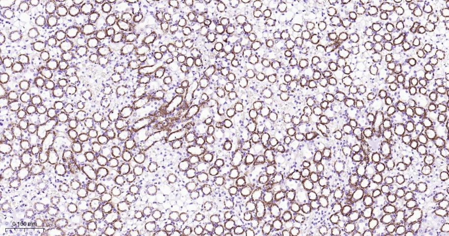 自噬相关蛋白4A重组兔单抗-bsm-61617R