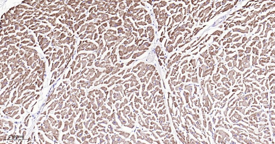 自噬相关蛋白4A重组兔单抗-bsm-61617R