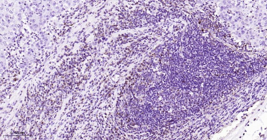 自噬相关蛋白4A重组兔单抗-bsm-61617R