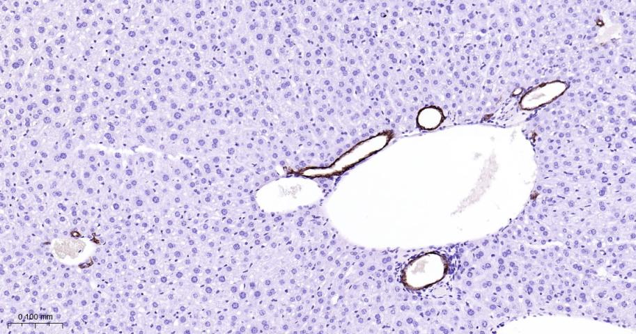 细胞角蛋白7重组兔单抗