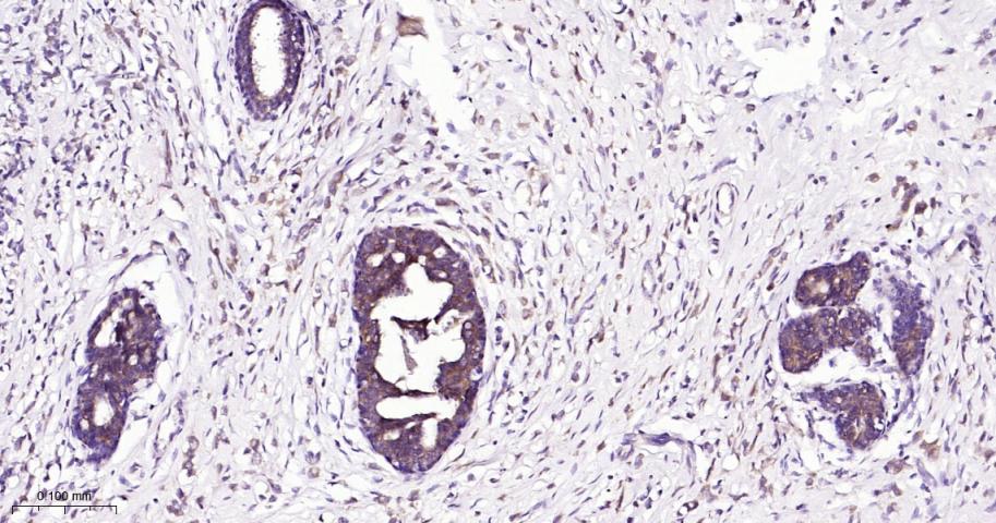 自噬蛋白5重组兔单抗